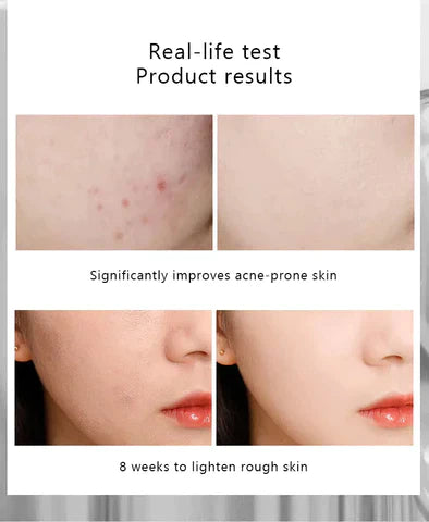 Niacinamide 10% + Zinc 1% With Batch Code The Ordinary Serum